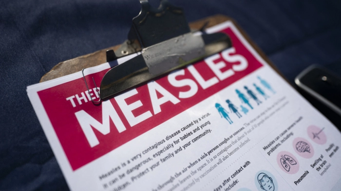 SPARTANBURG, SOUTH CAROLINA - FEBRUARY 6: A fact sheet for measles sits on a table at a mobile clinic offering free vaccinations on February 6, 2026 in Spartanburg, South Carolina. The clinic offered free MMR vaccinations as the South Carolina Department of Health reported 876 cases of measles earlier in the week, most centered in Spartanburg County. Sean Rayford/Getty Images/AFP (Photo by Sean Rayford / GETTY IMAGES NORTH AMERICA / Getty Images via AFP)