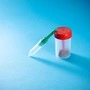 Mikrobiom-Tests für zu Hause: Experten sehen „keinen Nutzen“ 