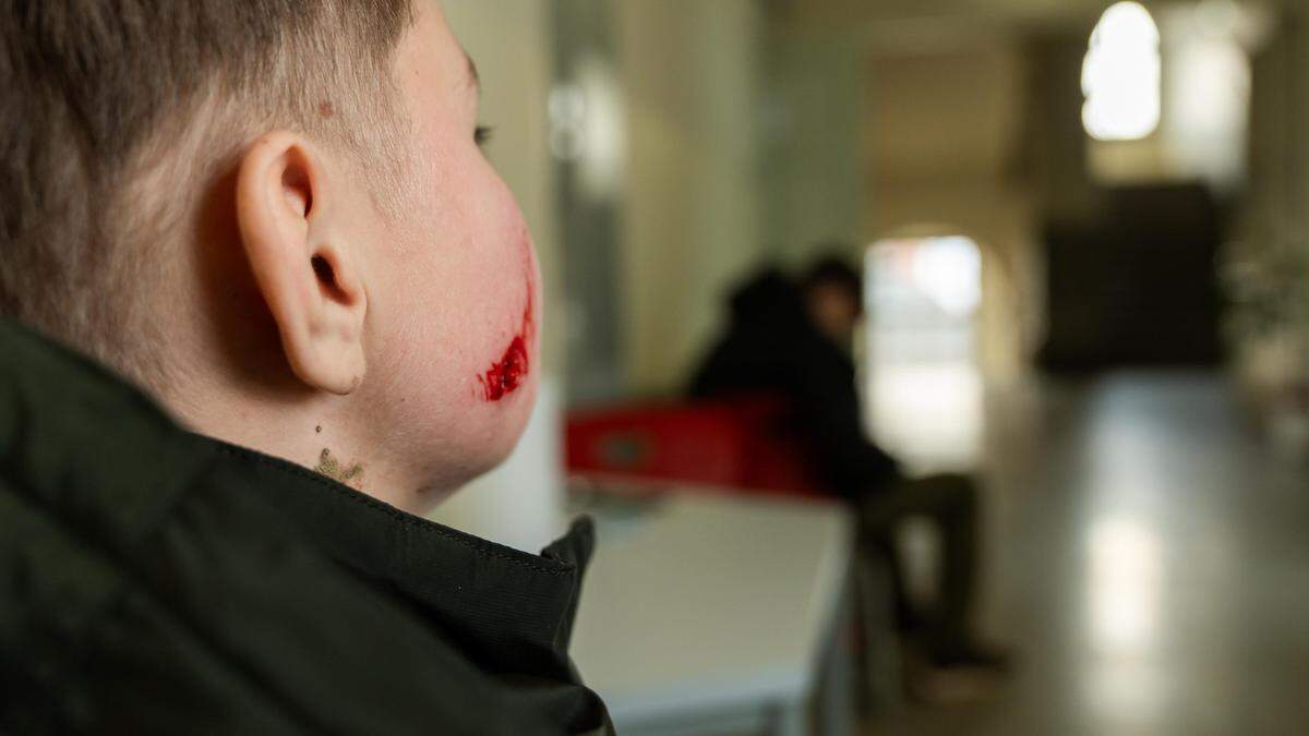Von einem Eisbrocken getroffen: ein Schüler nach einem Vorfall an einer Grazer Mittelschule (Die KlZ war dort im Dezember für eine Reportage unterwegs)