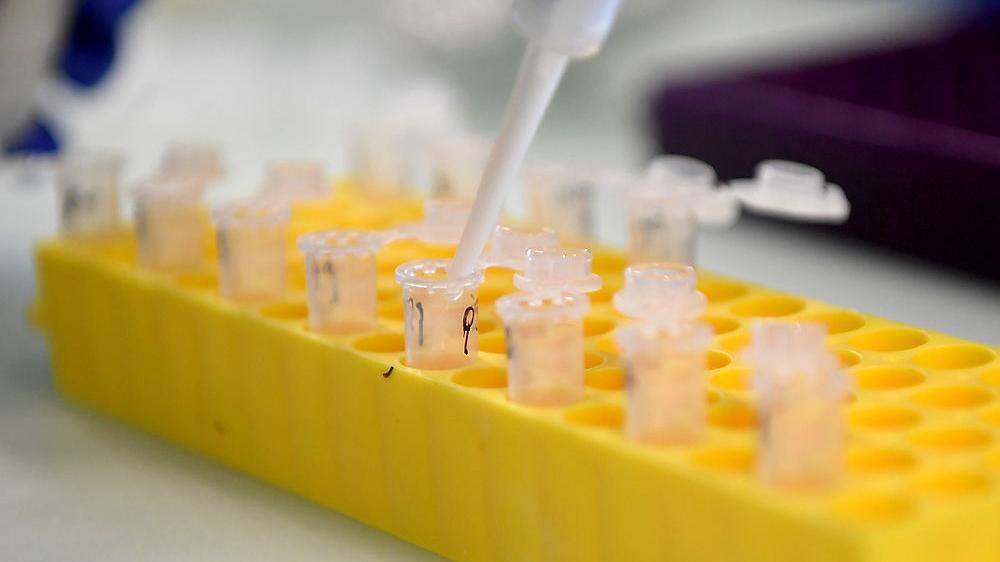 Die Zahl der Neuinfektionen sinkt, die Zahl der Labortests allerdings auch