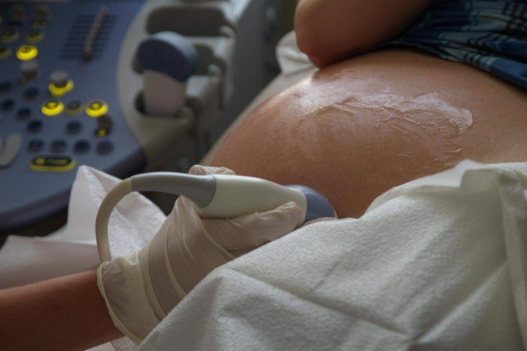 Schwangere verwechselt: Prager Spital führte irrtümlich eine Abtreibung durch