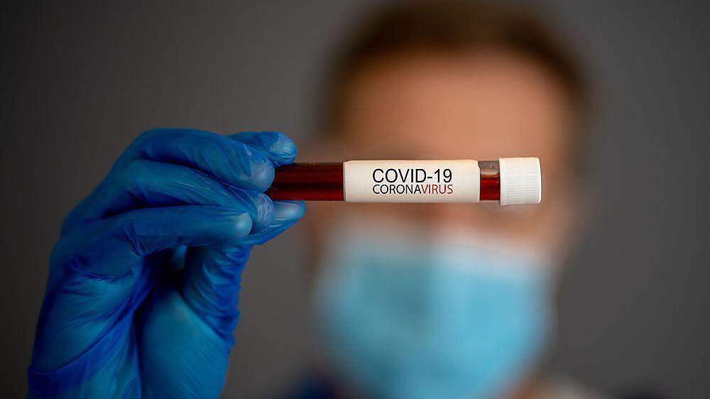 Coronavirus: Expertenstreit um Antikörpertests 