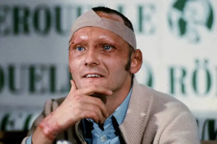 Das Bild vom 8.09.1976 zeigt Niki Lauda mit vernarbtem Gesicht, Kopfbandage und Brandwunden während einer Pressekonferenz in Salzburg. Lauda kündigte an, dass er nach seiner Genesung wieder Autorennen fahren werde.