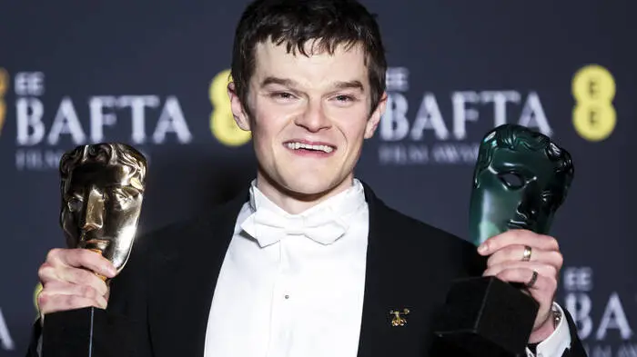 Robert Aramayo gehörte zu den großen Siegern des Abends. Der Schauspieler setzte sich überraschend gegen seine prominenten Mitnominierten durch. „Ich kann das absolut nicht glauben. Ich kann nicht glauben, dass ich Menschen wie euch gegenüberstehe.“