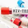HIV-Test