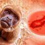 Das Nationale Impfgremium empfiehlt Affenpocken-Impfung für Risikogruppen