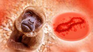 Das Nationale Impfgremium empfiehlt Affenpocken-Impfung für Risikogruppen