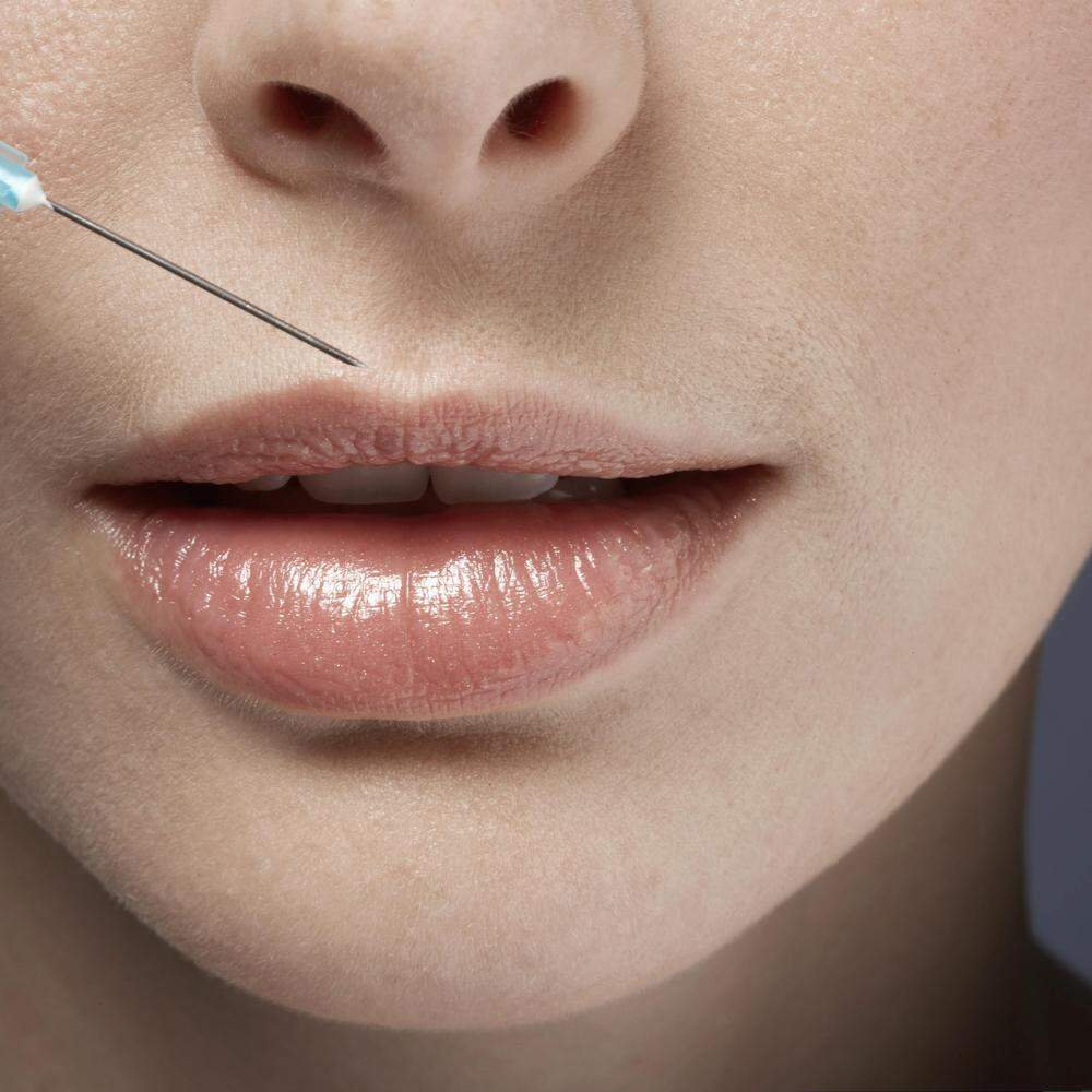 Schönheitseingriff  28-Jährige starb nach Lippen-Aufspritzen, Familie  wirft Klinik schlampige Arbeit vor