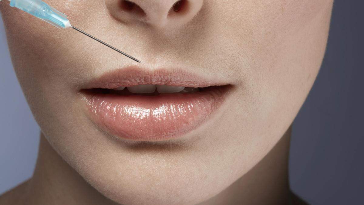 28-Jährige starb nach dem Aufspritzen der Lippen | Welche Substanz der Frau gespritzt wurde, ist noch unklar