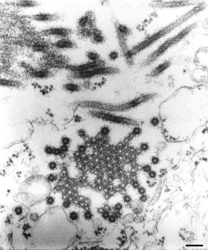 Das Marburg-Virus unter dem Elektronenmikroskop