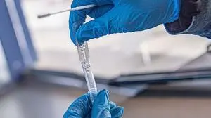 Die Auswertung der Proben dauerte vor allem am Wochenende lang