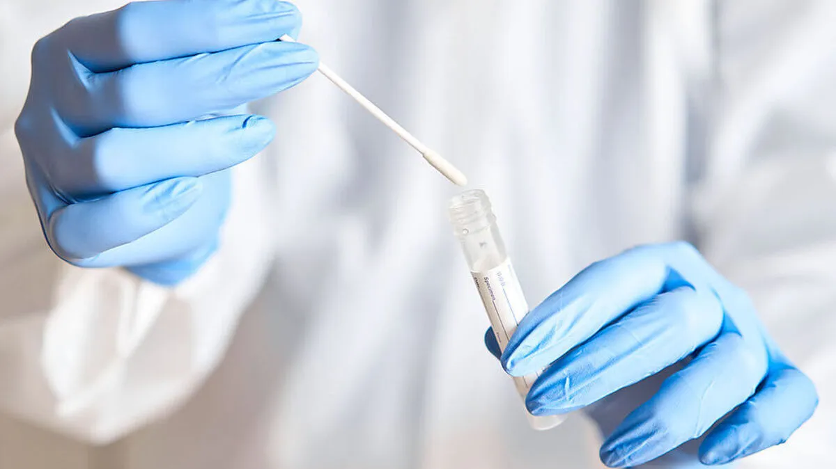 Rund die Hälfte aller positiven Tests werden im Bezirk bei den niedergelassenen Ärzten gemacht