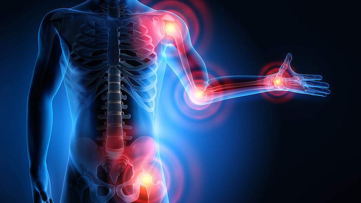 Autoimmunerkrankung: Kann ich gegen Covid-19 geimpft werden?