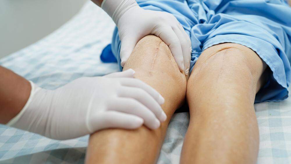 Amputation: Beinahe hätte eine 25-Jährige ihr Bein verloren