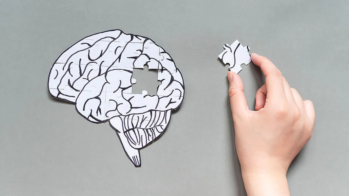 Ein neues Alzheimer-Medikament gibt Patienten Hoffnung. Wie wirksam es wirklich ist, muss erst abschließend geklärt werden 