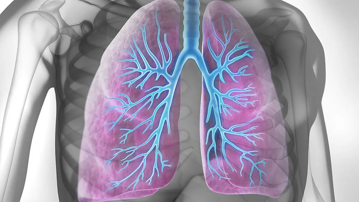 Verengungen der Luftröhre können lebensbedrohlich sein 