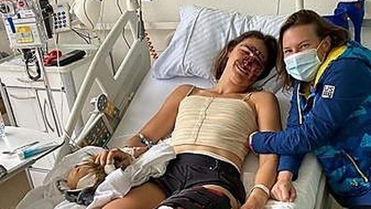 Alice Merryweather mit schweren Gesichtsverletzungen im Krankenhaus