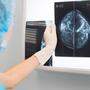 Alle zwei Jahren können Frauen ab 45 Jahren zur Mammografie