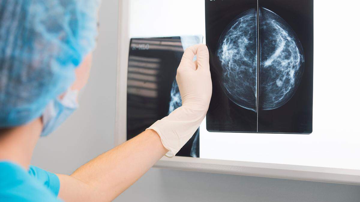 Alle zwei Jahren können Frauen ab 45 Jahren zur Mammografie