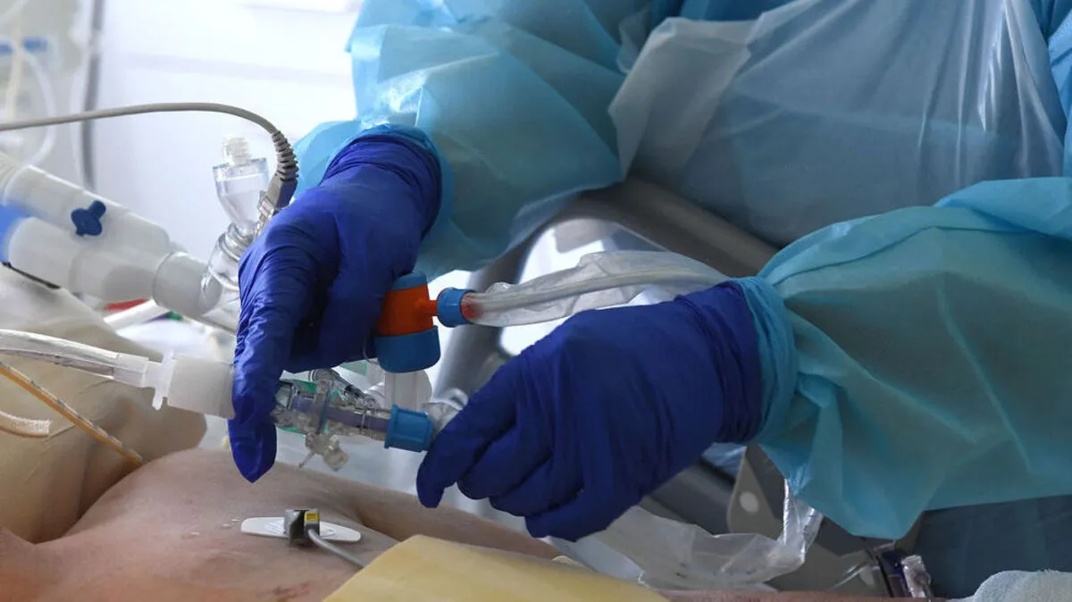 Immer mehr Covid-Patienten müssen in Österreich intensivmedizinisch betreut werden.