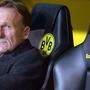 Dortmund-Geschäftsführer Hans-Joachim Watzke sieht etwas skeptisch in die Zukunft