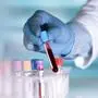 hands of a lab technician with a tube of blood sample and a rack with other samples / lab technician holding blood tube sample for study