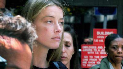 Amber Heard mit Verletzungen im Gesicht vor Gericht