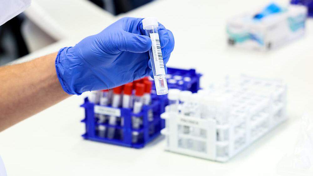 PCR-Testauswertung läuft weiter nicht reibungslos