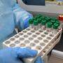 492 weitere PCR-Proben wurden genommen 