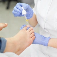 Besteht der Verdacht auf Nagelpilz, sollte man diesen ärztlich abklären lassen.