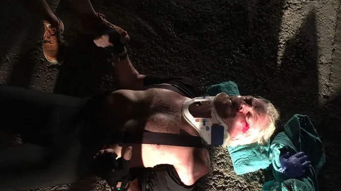 Der britische Milliardär und Geschäftsmann Richard Branson (66) hat sich bei einem Fahrradsturz verletzt und hat diese Fotos gepostet...