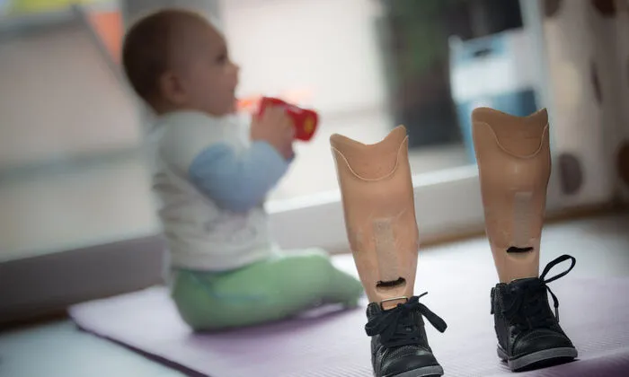 Als Baby wurden Niko beide Beine bis zum Knie amputiert 