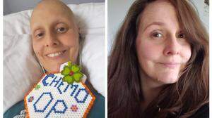 Nadja Kapeller am Ende der Chemotherapie und fünf Jahre danach | Nadja Kapeller am Ende der Chemotherapie und fünf Jahre danach