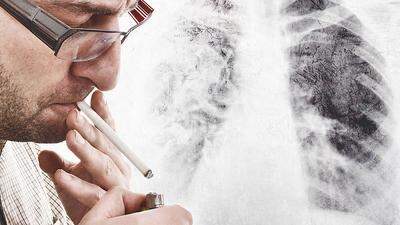 Rauchen ist die Hauotursache für Lungenkrebs