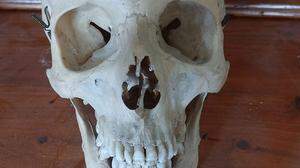 Der Schädel ist rund 120 Jahre alt und befand sich seit Generationen in Besitz einer steirischen Ärztefamilie