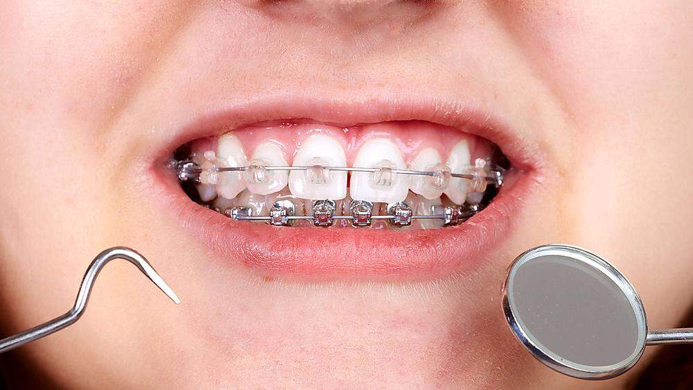 Die Gratis-Zahnspangebraucht an einigen Stellen Reparaturen, sagen Kritiker