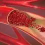 3d illustration of a constricted and narrowed artery and the blood cannot flow properly called arteriosclerosis