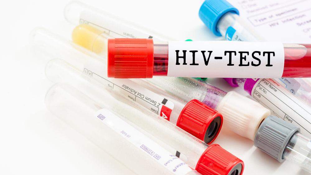 Der Aids-Test soll zur Selbstverständlichkeit werden - das will die Kampagne #einfachtesten bewirken