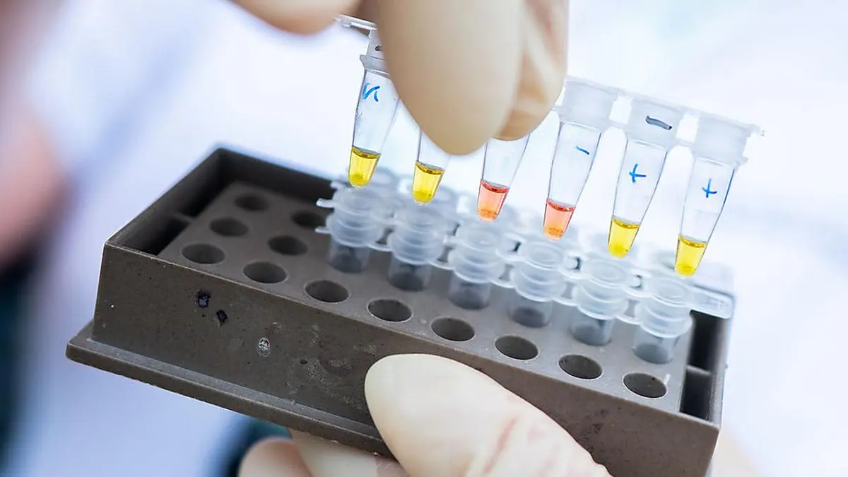 ABD0062_20200928 - WIEN - ÖSTERREICH: Eine Frau hält negativ und positv getestete Proben für das Analyse-Gerät im "Cluster-Buster-Bus" am Montag, 28. September 2020, im Rahmen eines Fototermins anl. der Präsentation in Wien. - FOTO: APA/GEORG HOCHMUTH