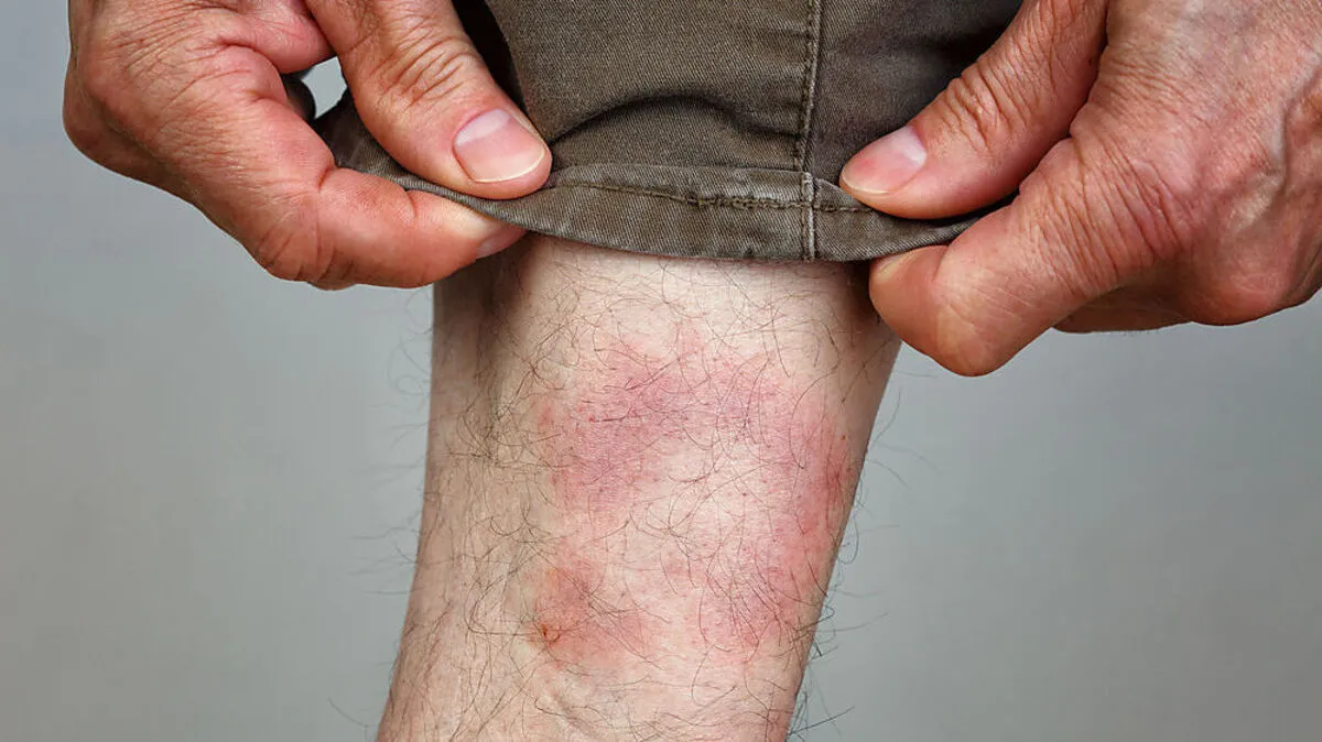 Die typische Wanderröte