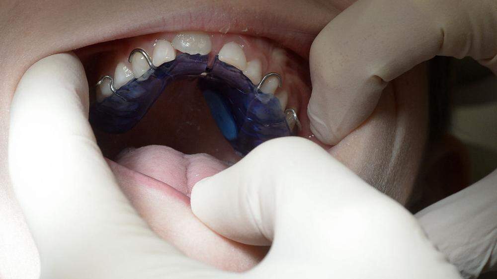 Die Frau soll Behandlungen vorgenommen haben, die nur Zahnärzten erlaub sind