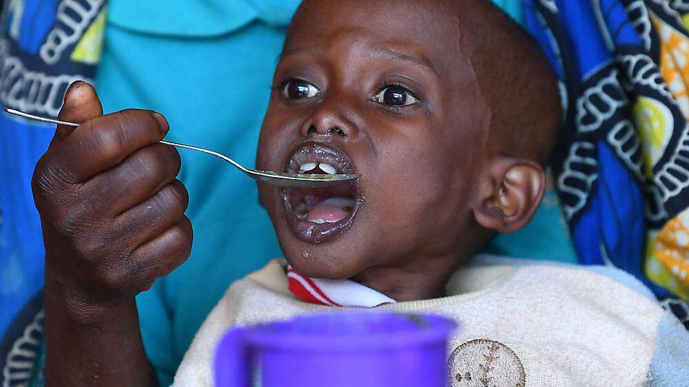In Afrika ist jedes dritte Kind unterernährt