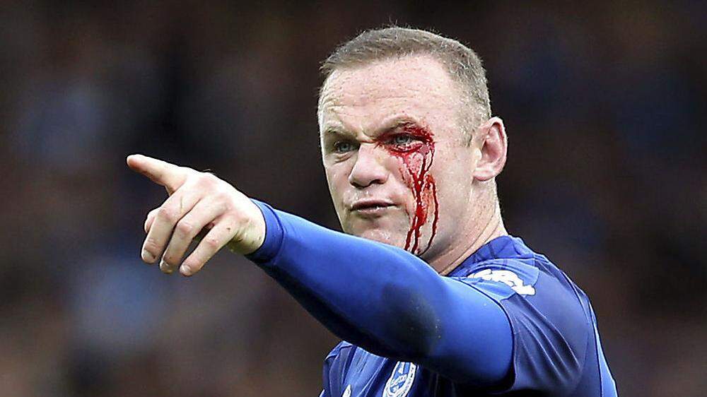 Wayne Rooney blutüberströmt