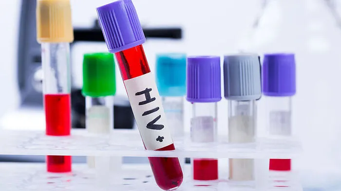 Mit diesem Test lässt sich innerhalb von 15 Minuten bestimmen, ob man HIV positiv ist oder nicht