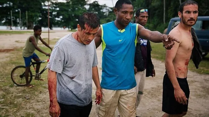 Verletzte Afghanen im Internierungslager in Manus, die von Menschen auf Papua-Neuguinea attackiert wurden 