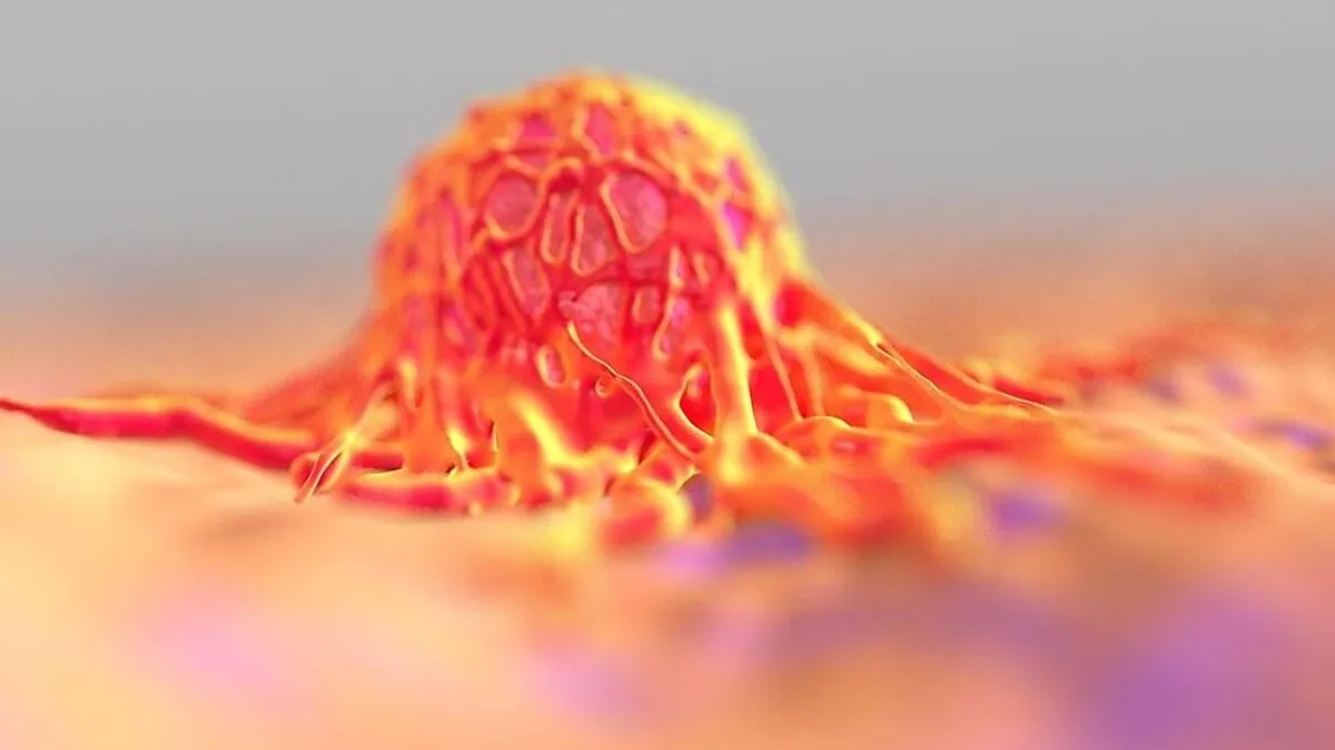 Damit sich der Krebs nicht ausbreiten kann, sind Vorsorgeuntersuchungen notwendig