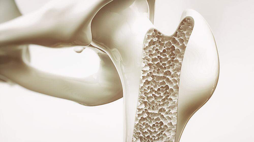 Knochenjob: Neues CD-Labor will Knochen mit dem 3D-Drucker herstellen