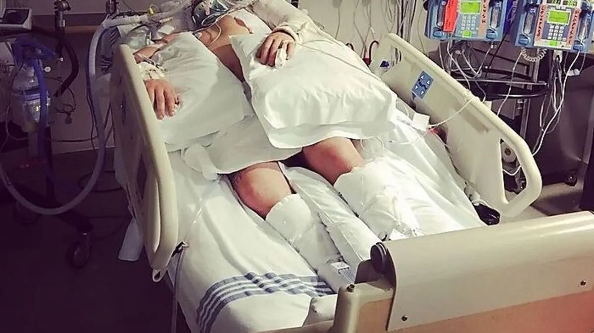 Mark McMorris lag lange im Spital, aber kehrte eindrucksvoll zurück