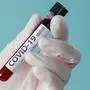 Hand holding testing patients blood samples for Coronavirus Outbreak (COVID-19) in laboratory, New coronavirus 2019-nCoV from Wuhan China concept, Empty space isolated on blue panorama banner