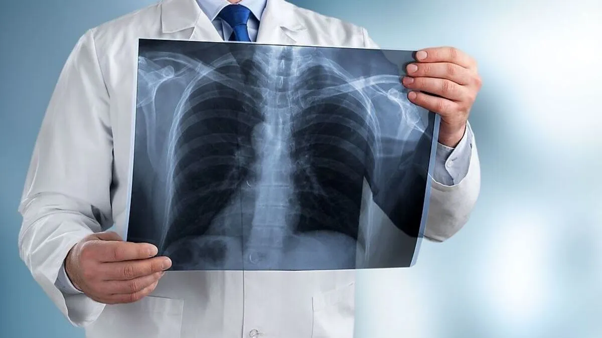 Die Antwort auf die Frage hängt davon an, ob es sich um digitale Daten handelt oder um konventionell angefertigte Bilder